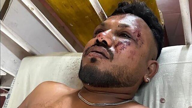 ¿Cómo sobrevivió el pasajero de Air India 'innecesario'? Los expertos en aviación pesan en Miracle Brit Vishwash Ramesh
