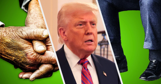 ¿Qué es la insuficiencia venosa crónica? La condición de Trump, explicó.
